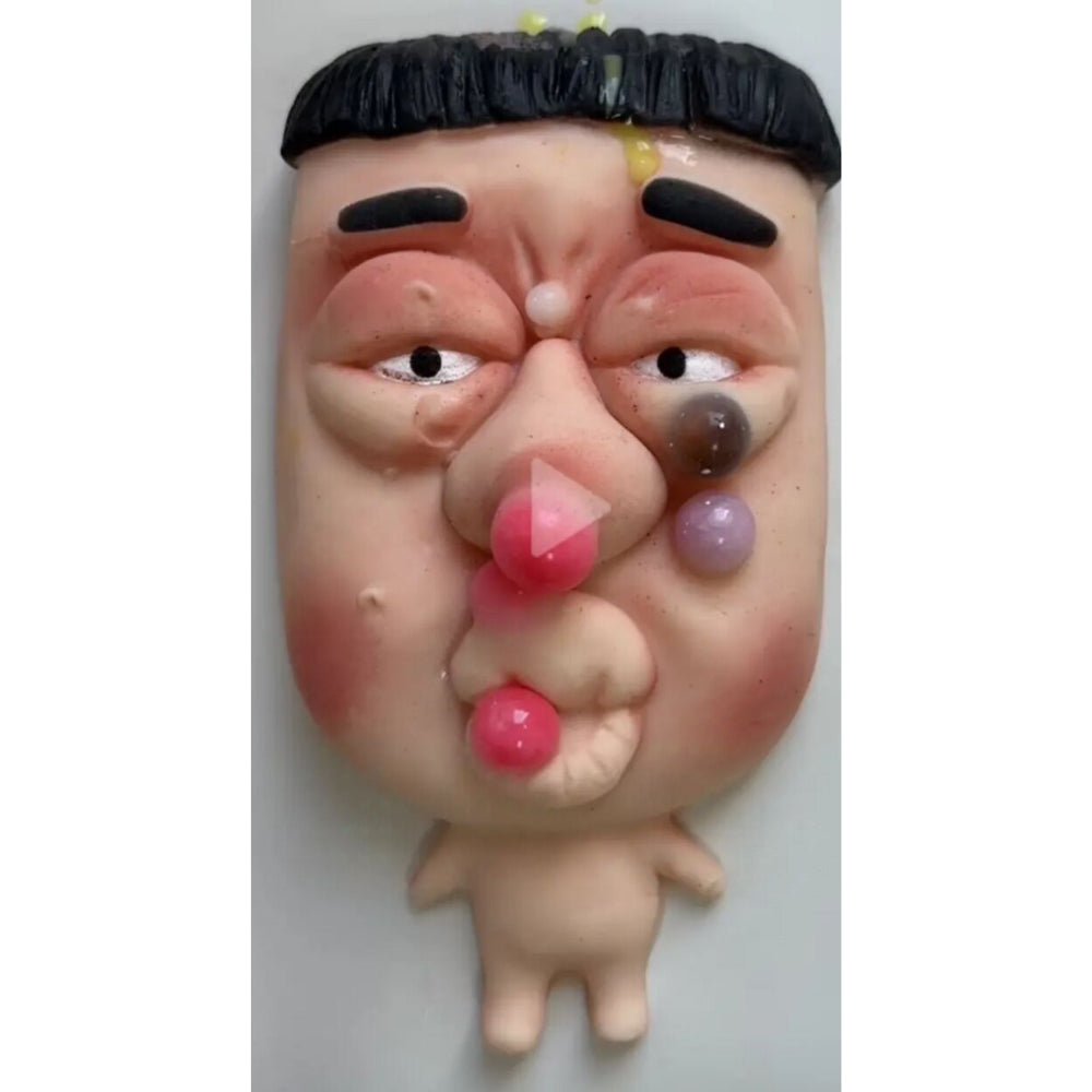 Realistic Pimple Popper Squeeze Toy